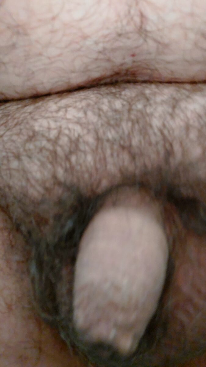 Kleiner haariger schläfer